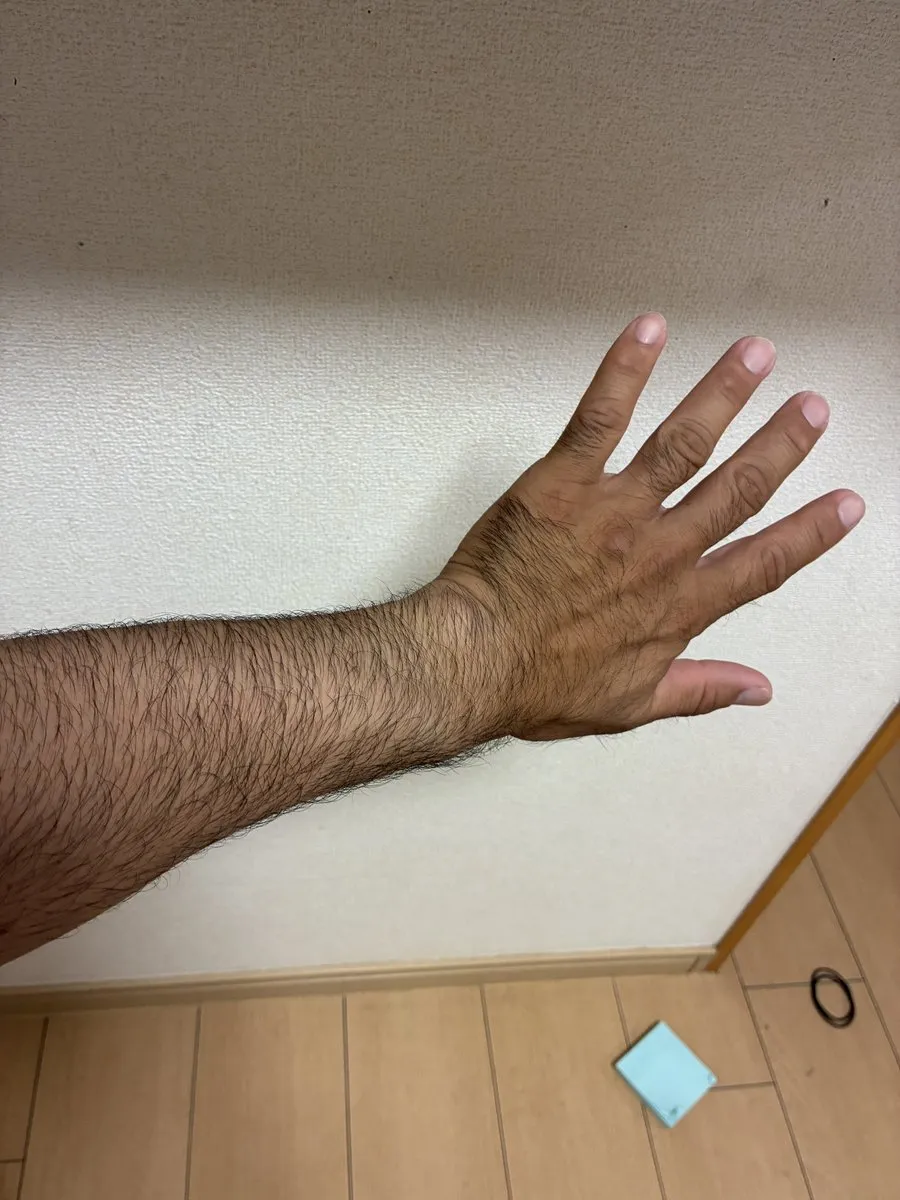 同じ「脱毛器」でも、別物だった