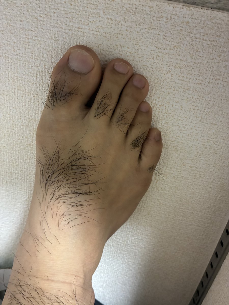 足の甲と指に毛が生えている様子