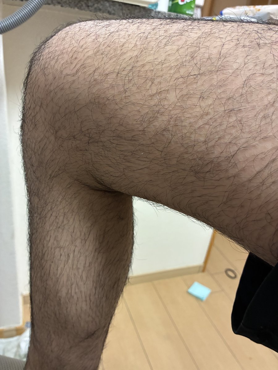 すねの毛が密集している様子